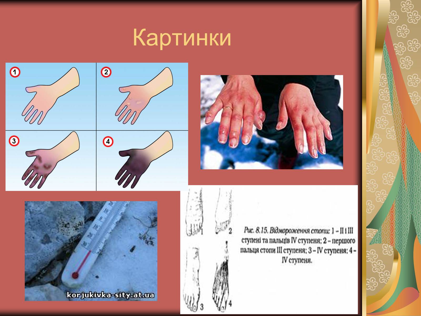 Презентація на тему «Перша допомога при опіках» (варіант 1) - Слайд #43 Презентація на тему «Перша допомога при опіках» (варіант 1) - Слайд #43