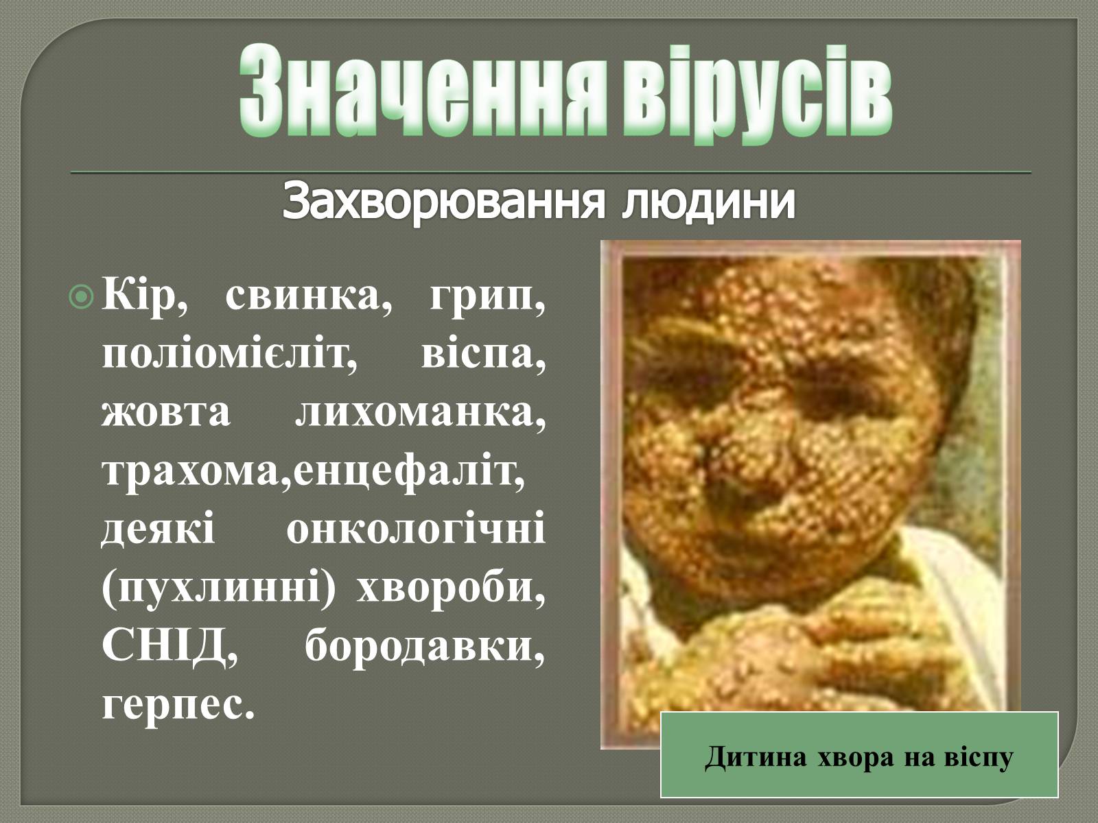 Презентація на тему «Роль вірусів у природі та житті людини» - Слайд #7 Презентація на тему «Роль вірусів у природі та житті людини» - Слайд #7