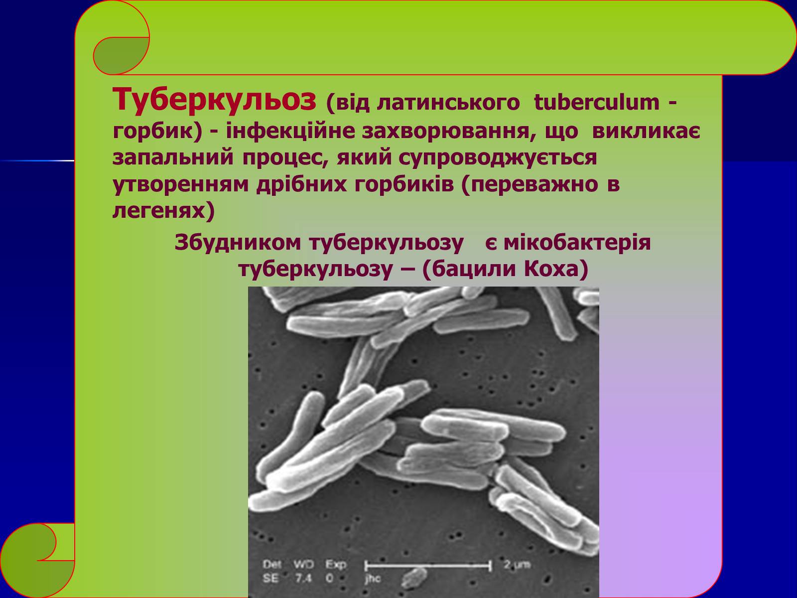 Презентація на тему «Інфекційні захворювання» (варіант 7) - Слайд #17 Презентація на тему «Інфекційні захворювання» (варіант 7) - Слайд #17