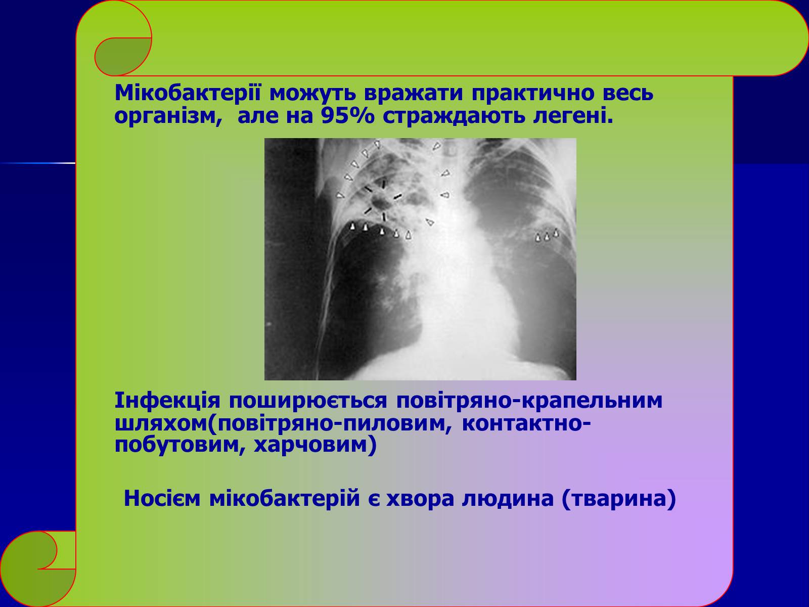 Презентація на тему «Інфекційні захворювання» (варіант 7) - Слайд #18 Презентація на тему «Інфекційні захворювання» (варіант 7) - Слайд #18