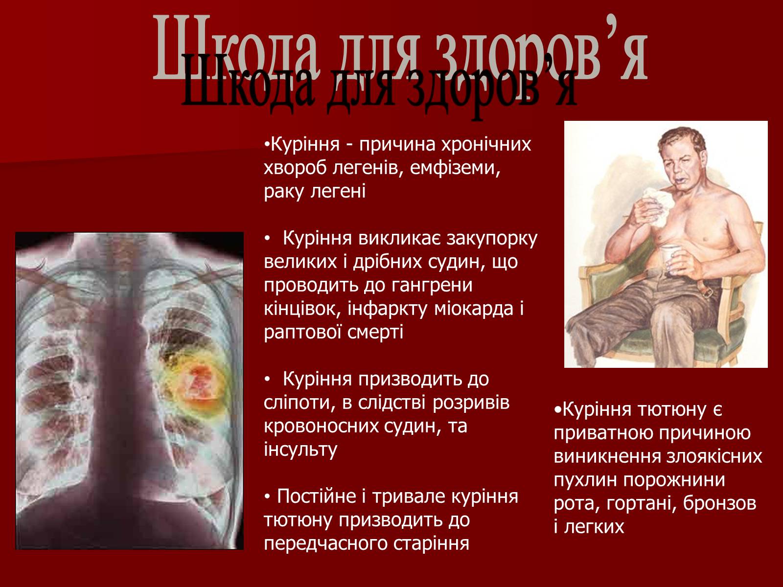 Презентація на тему «Куріння» (варіант 6) - Слайд #10 Презентація на тему «Куріння» (варіант 6) - Слайд #10