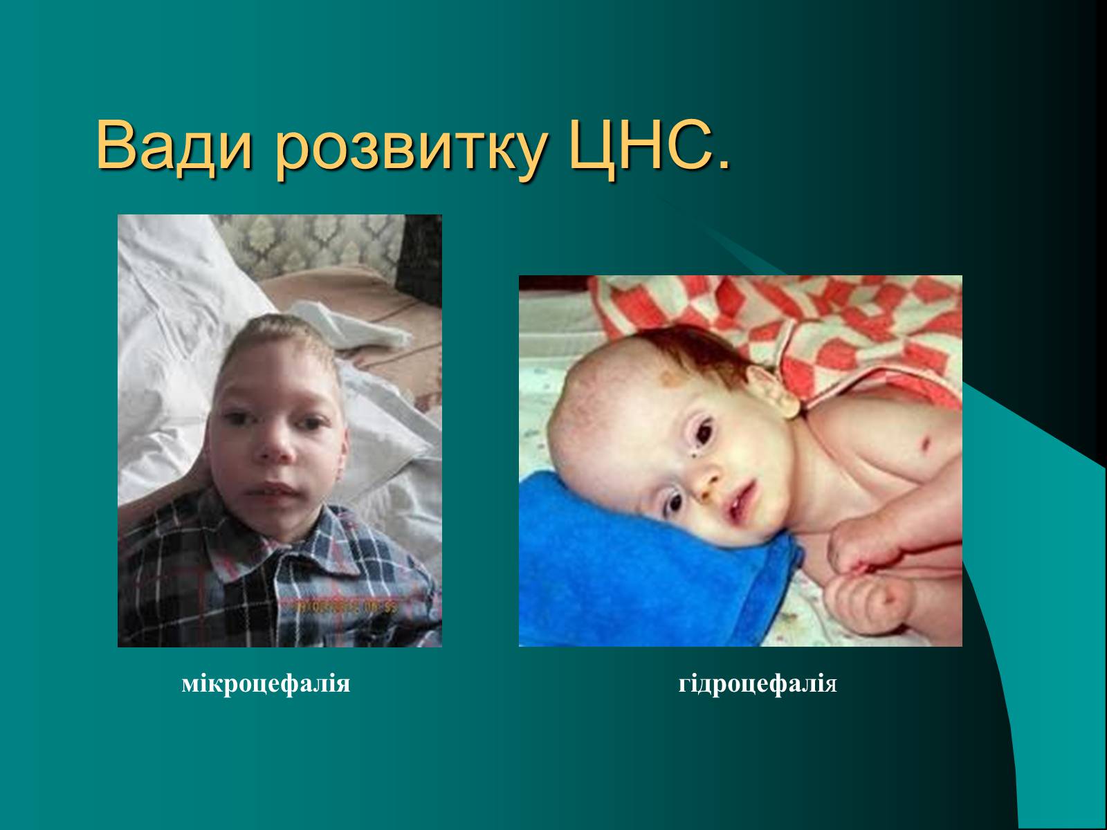 Презентація на тему «Вади розвитку організмів» (варіант 2) - Слайд #10 Презентація на тему «Вади розвитку організмів» (варіант 2) - Слайд #10