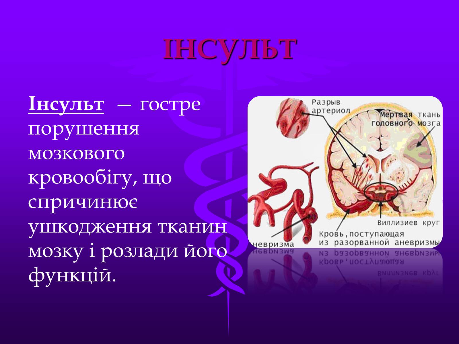 Презентація на тему «Хвороби серцево-судинної системи» (варіант 3) - Слайд #12 Презентація на тему «Хвороби серцево-судинної системи» (варіант 3) - Слайд #12