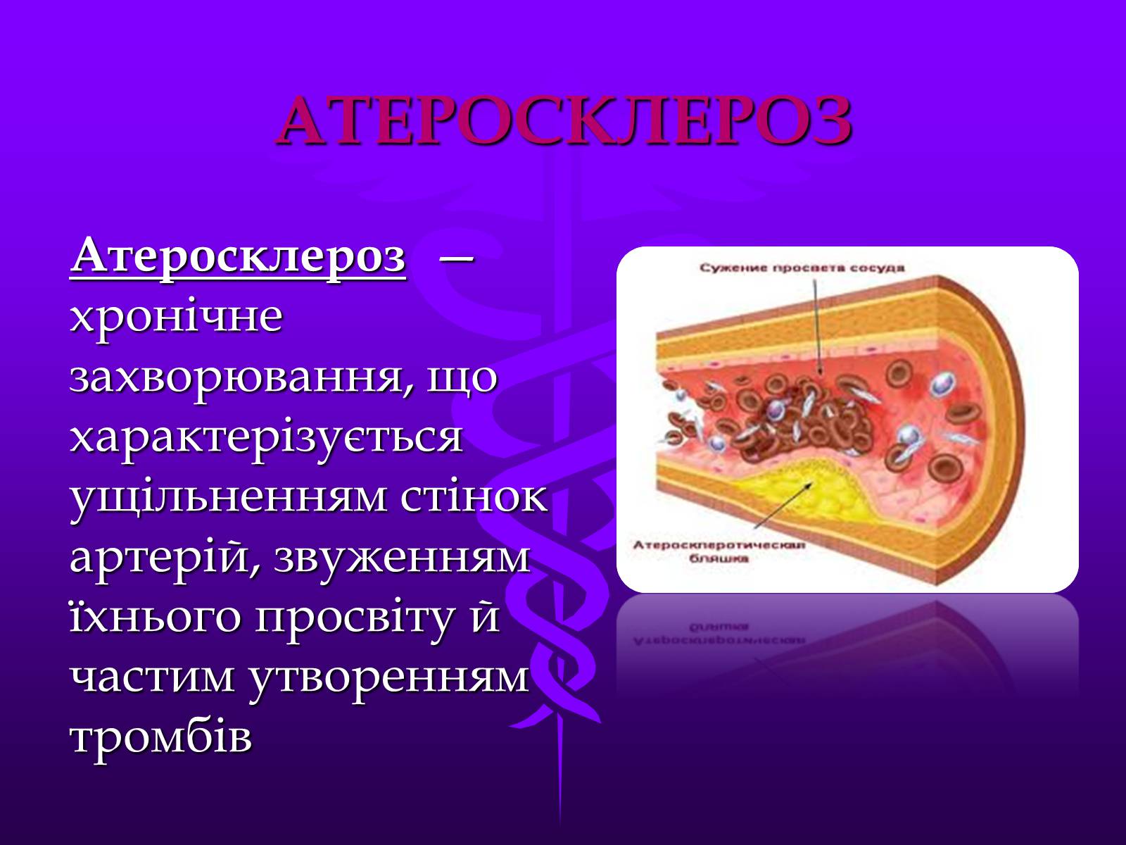 Презентація на тему «Хвороби серцево-судинної системи» (варіант 3) - Слайд #16 Презентація на тему «Хвороби серцево-судинної системи» (варіант 3) - Слайд #16