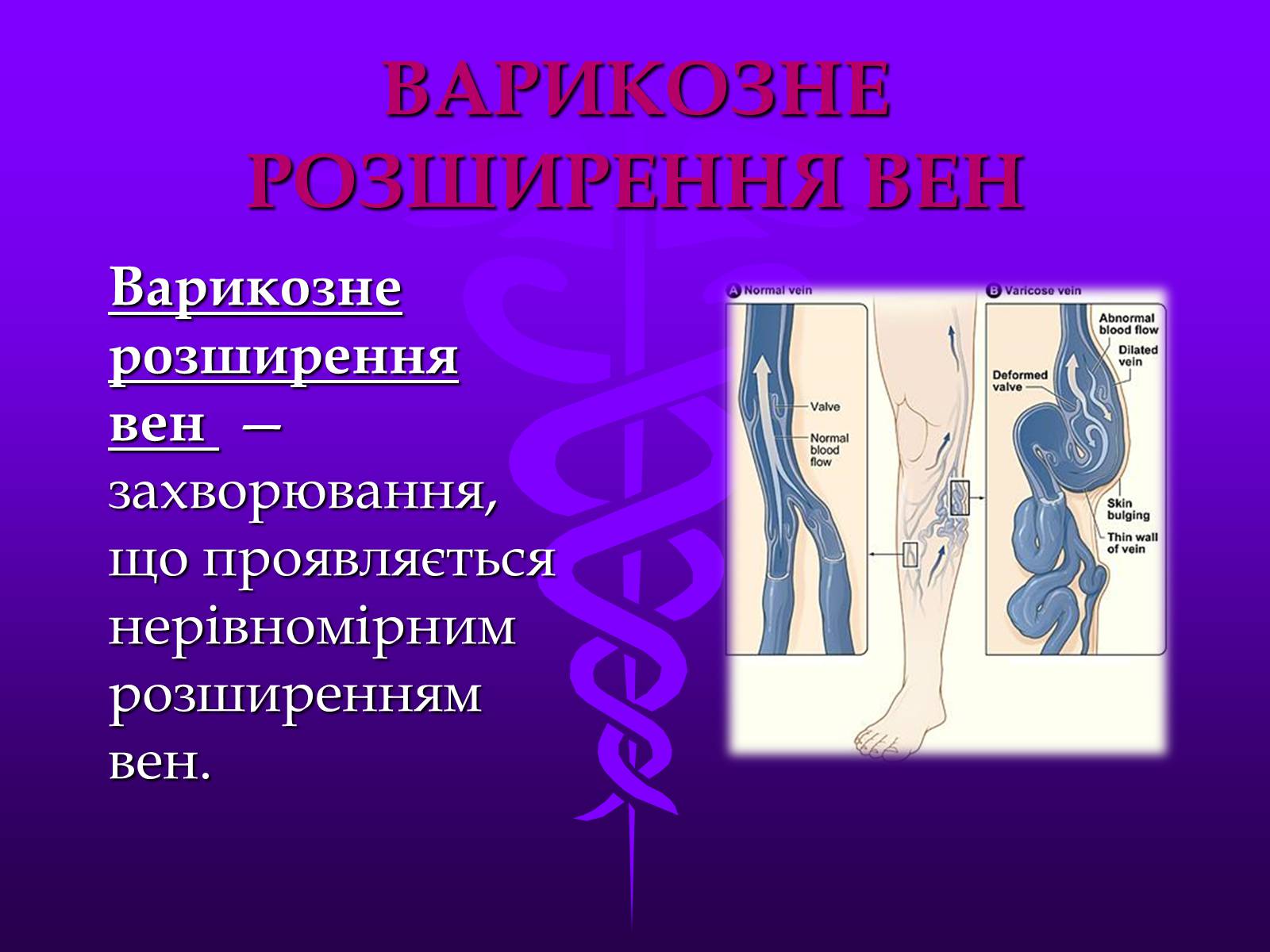 Презентація на тему «Хвороби серцево-судинної системи» (варіант 3) - Слайд #19 Презентація на тему «Хвороби серцево-судинної системи» (варіант 3) - Слайд #19