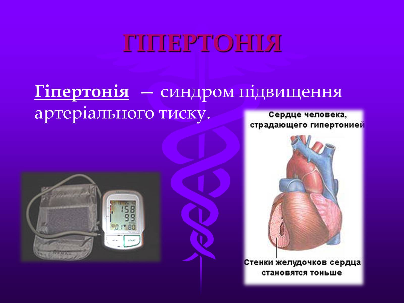 Презентація на тему «Хвороби серцево-судинної системи» (варіант 3) - Слайд #7 Презентація на тему «Хвороби серцево-судинної системи» (варіант 3) - Слайд #7
