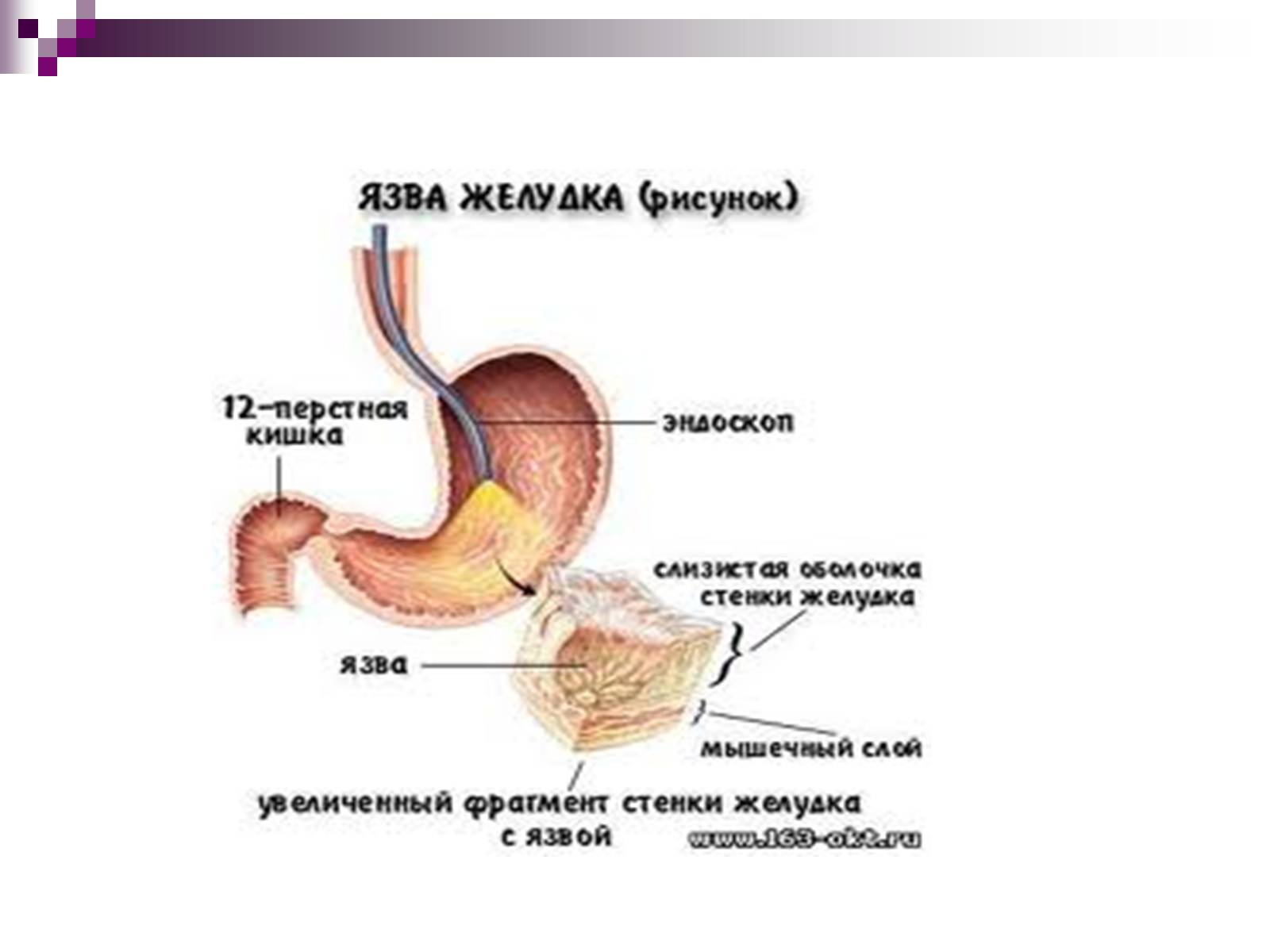Презентація на тему «Вплив спиртів на організм людини» - Слайд #7 Презентація на тему «Вплив спиртів на організм людини» - Слайд #7