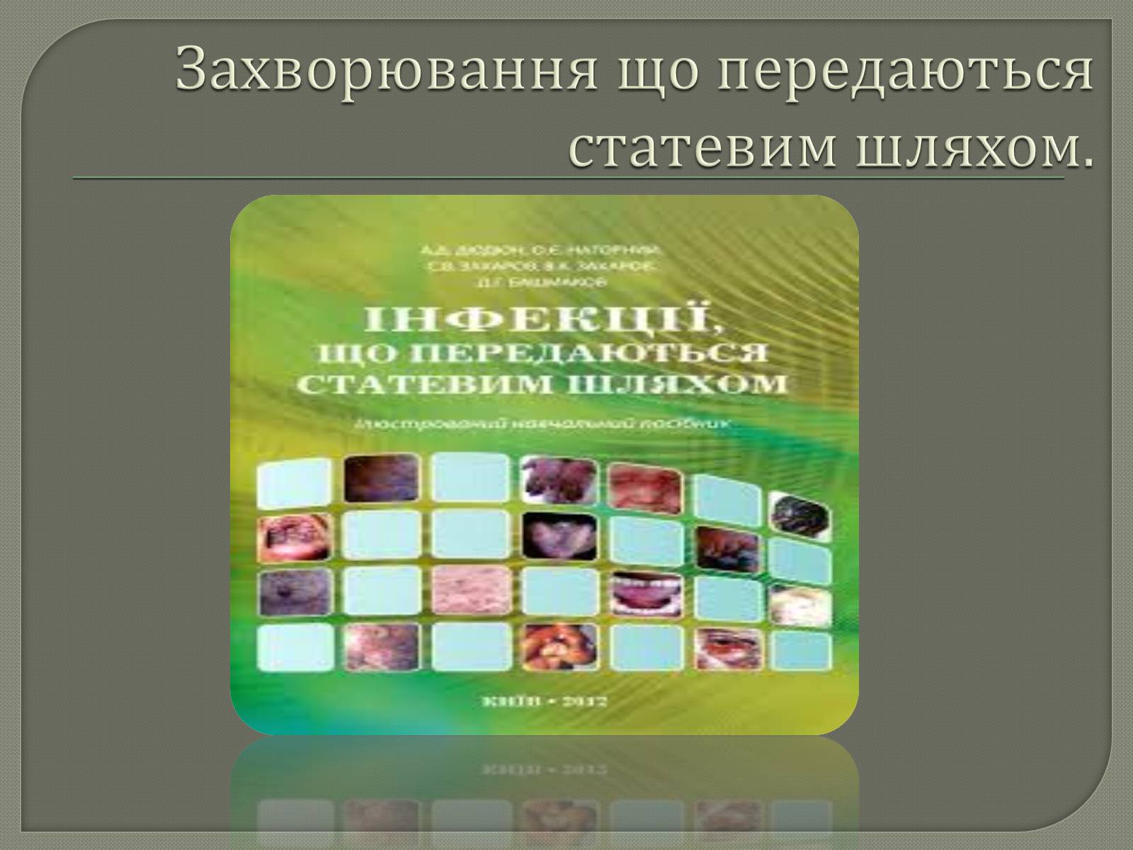 Презентація на тему «Захворювання що передаються статевим шляхом» - Слайд #1 Презентація на тему «Захворювання що передаються статевим шляхом» - Слайд #1