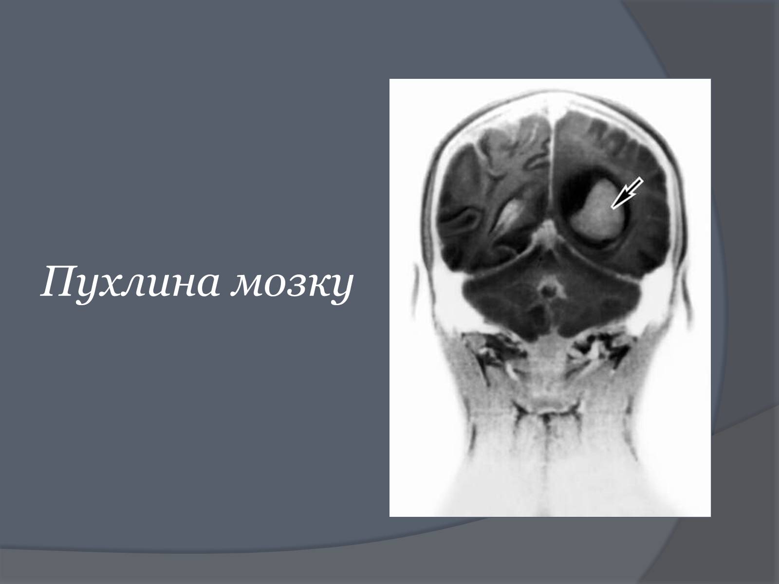 Презентація на тему «Вплив Мобільного телефону на здоров’я людини» - Слайд #32 Презентація на тему «Вплив Мобільного телефону на здоров’я людини» - Слайд #32