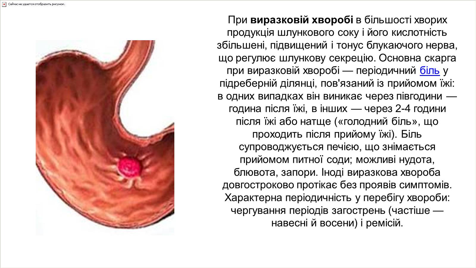 Презентація на тему «Хвороби органів травлення» - Слайд #3 Презентація на тему «Хвороби органів травлення» - Слайд #3