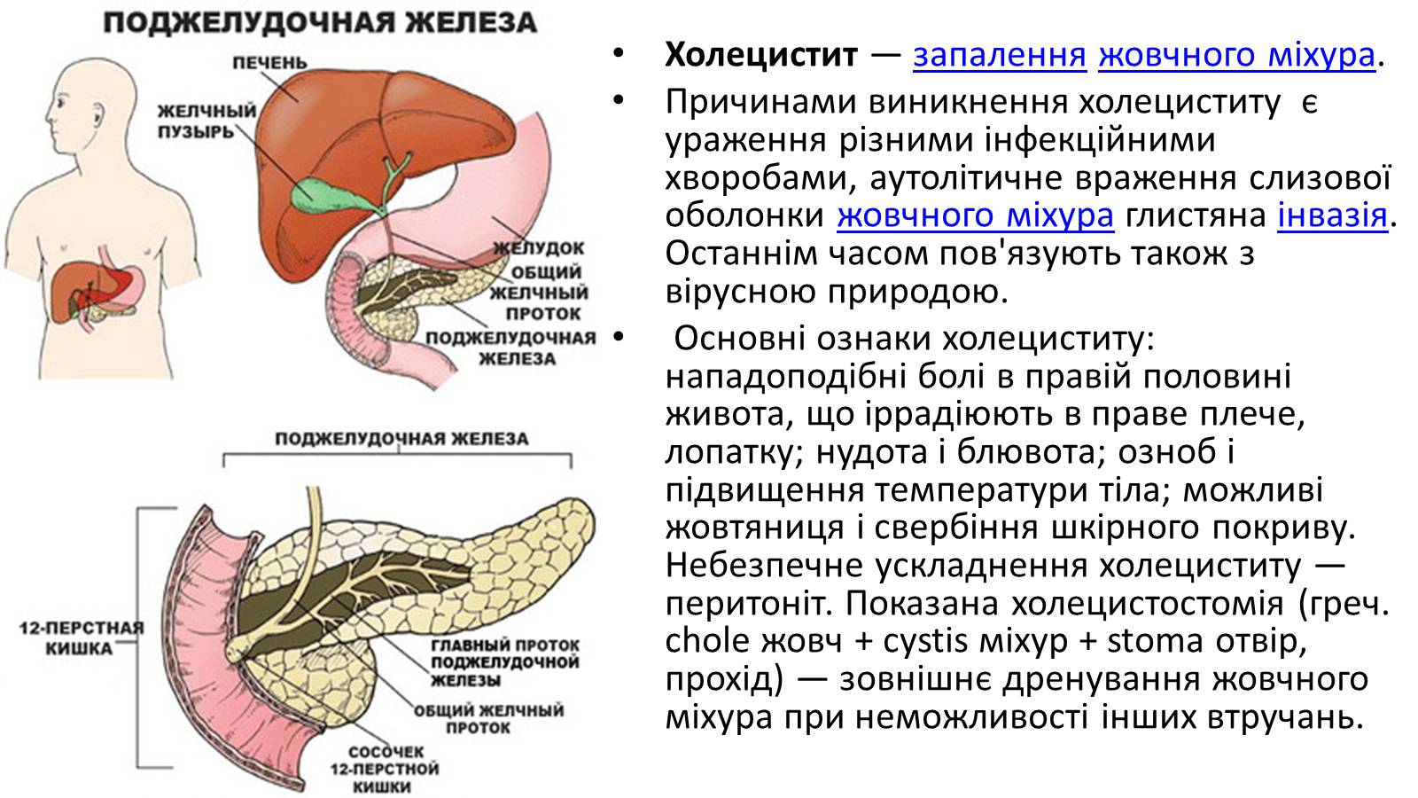 Презентація на тему «Хвороби органів травлення» - Слайд #8 Презентація на тему «Хвороби органів травлення» - Слайд #8