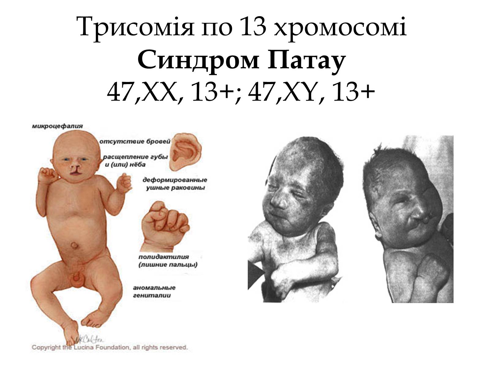 Презентація на тему «Хромосомні хвороби» (варіант 1) - Слайд #2 Презентація на тему «Хромосомні хвороби» (варіант 1) - Слайд #2