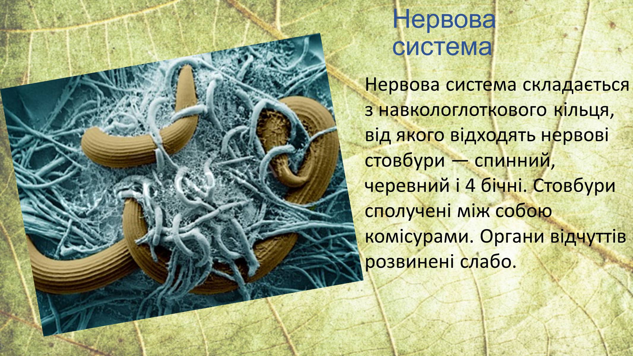 Презентація на тему «Круглі черви» - Слайд #12 Презентація на тему «Круглі черви» - Слайд #12