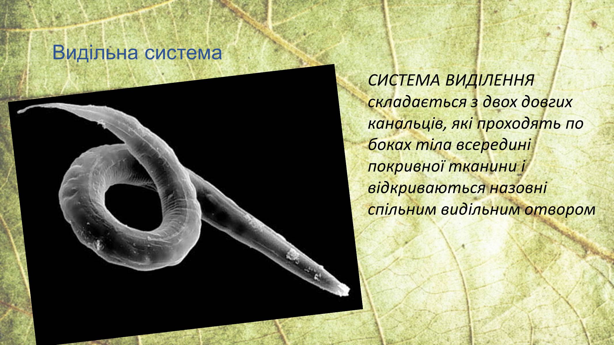 Презентація на тему «Круглі черви» - Слайд #14 Презентація на тему «Круглі черви» - Слайд #14
