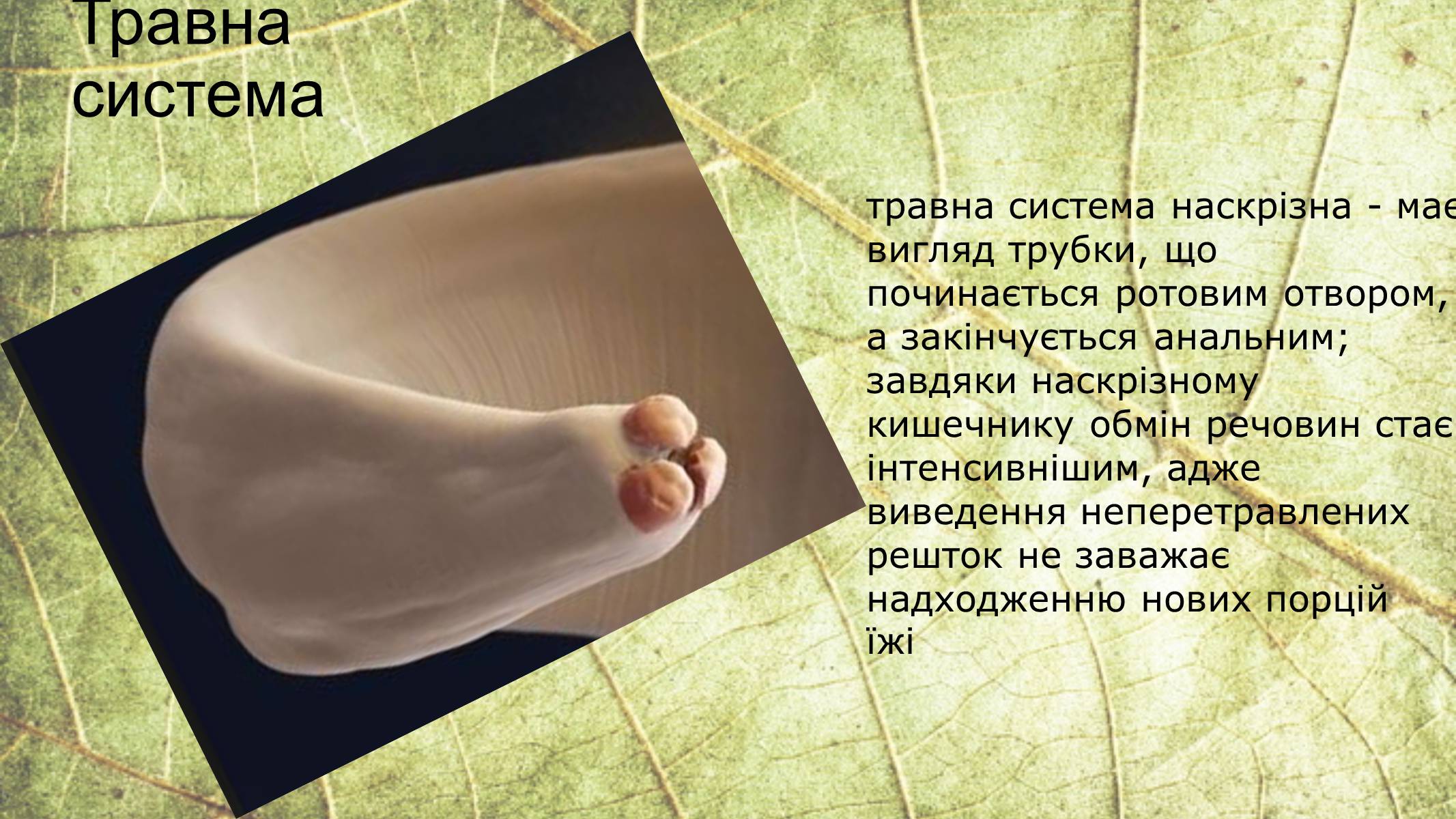 Презентація на тему «Круглі черви» - Слайд #15 Презентація на тему «Круглі черви» - Слайд #15