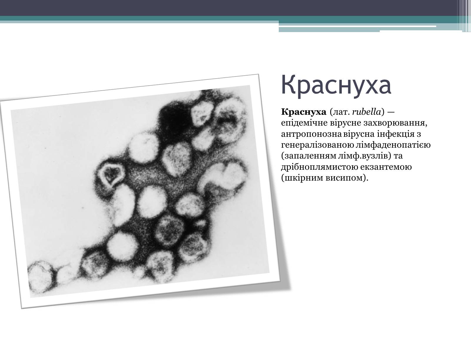 Презентація на тему «Дитячі інфекційні захворювання» - Слайд #13 Презентація на тему «Дитячі інфекційні захворювання» - Слайд #13