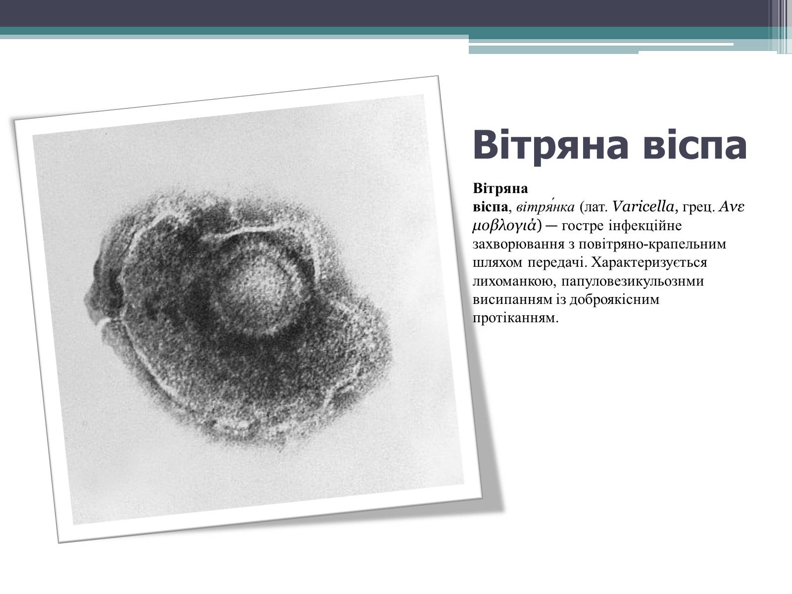 Презентація на тему «Дитячі інфекційні захворювання» - Слайд #15 Презентація на тему «Дитячі інфекційні захворювання» - Слайд #15