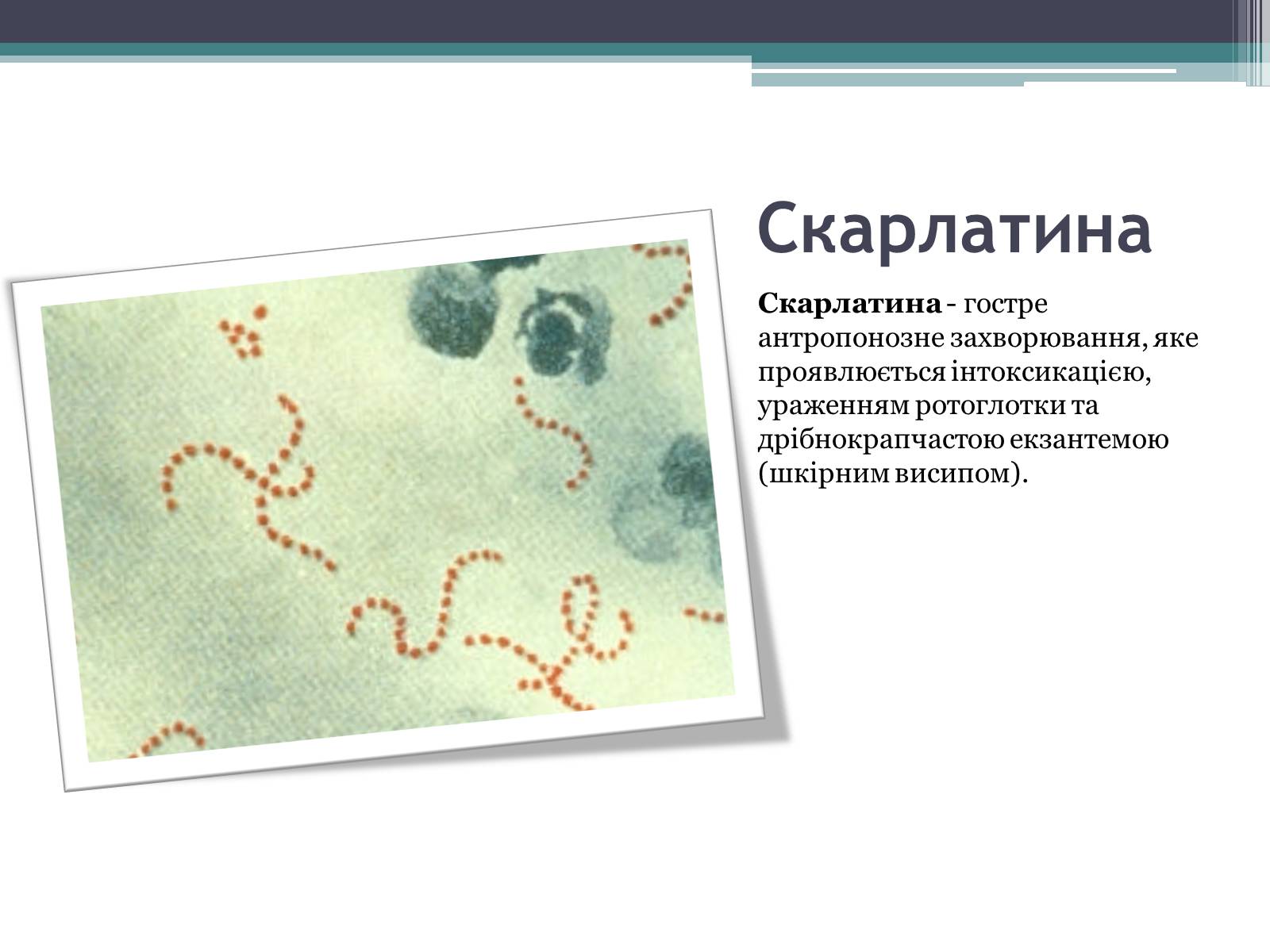Презентація на тему «Дитячі інфекційні захворювання» - Слайд #5 Презентація на тему «Дитячі інфекційні захворювання» - Слайд #5