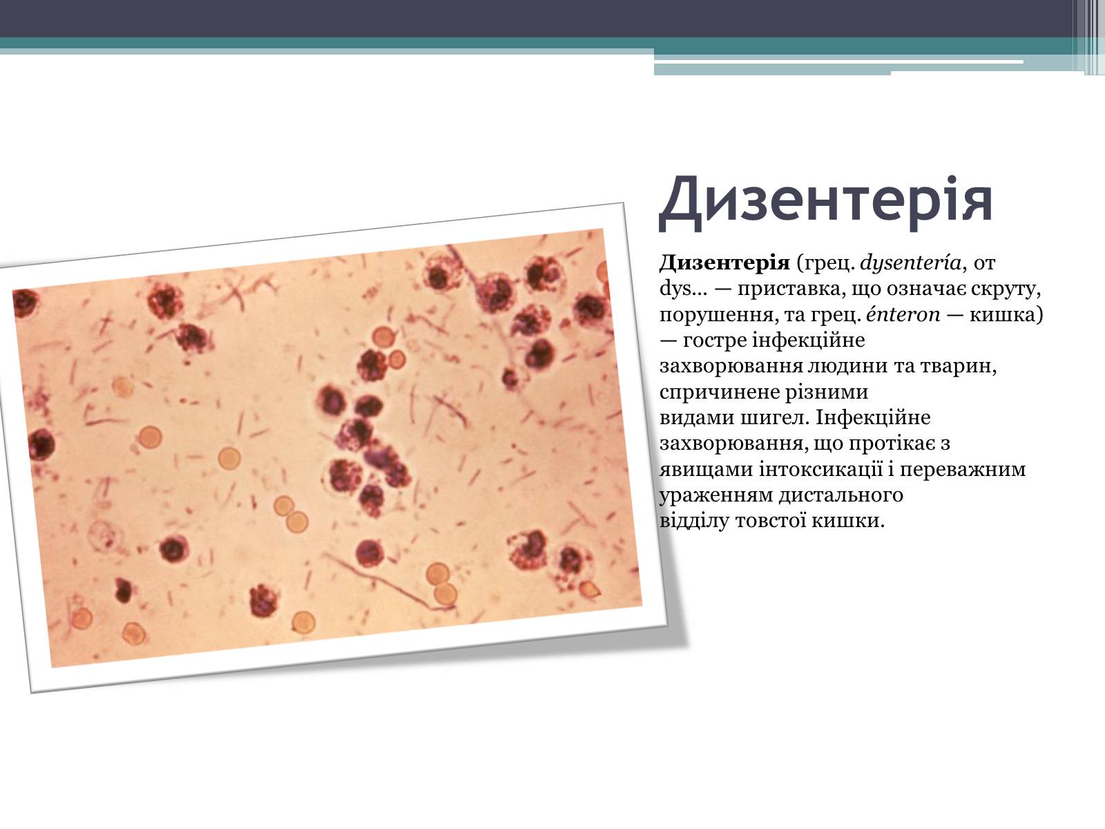 Презентація на тему «Дитячі інфекційні захворювання» - Слайд #8 Презентація на тему «Дитячі інфекційні захворювання» - Слайд #8