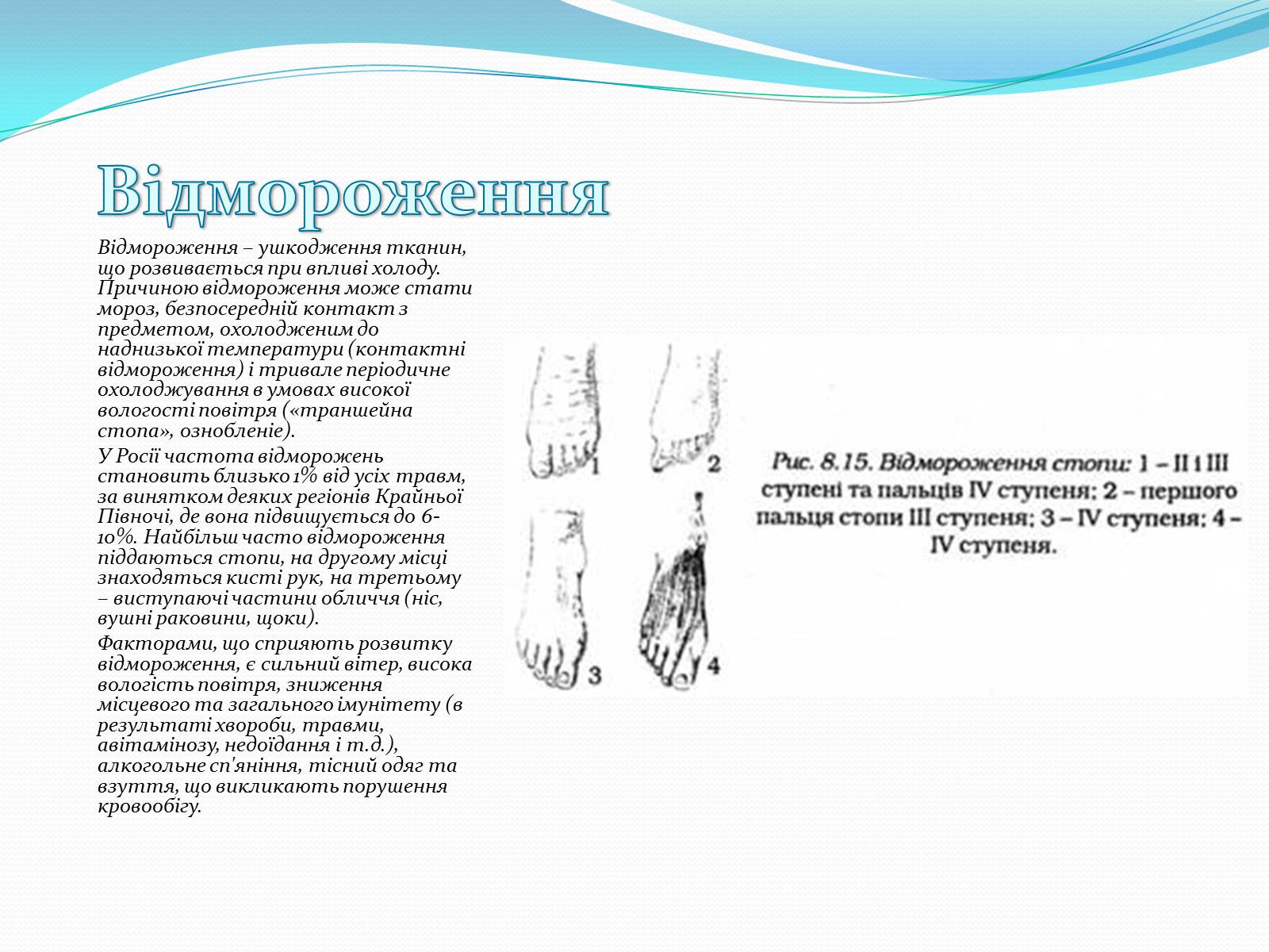 Презентація на тему «Травми кісток і суглобів» - Слайд #7 Презентація на тему «Травми кісток і суглобів» - Слайд #7