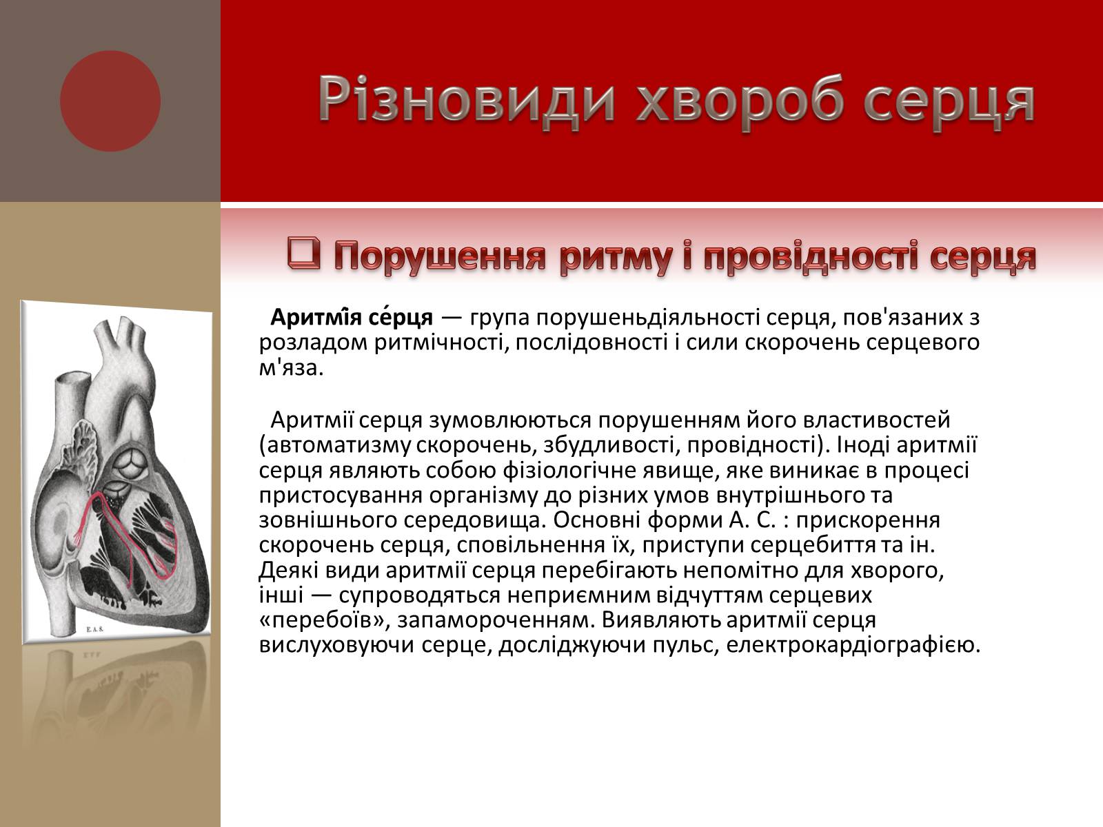 Презентація на тему «Захворювання серцево-судинної системи» (варіант 1) - Слайд #10