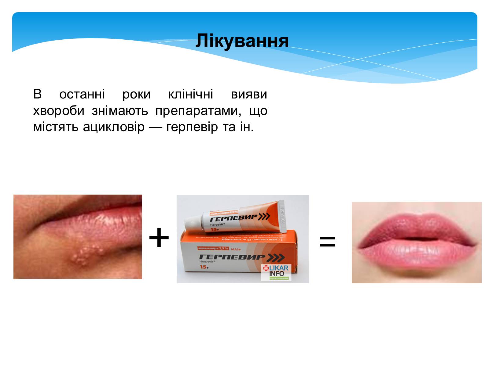 Презентація на тему «Інфекційні захворювання» (варіант 5) - Слайд #14 Презентація на тему «Інфекційні захворювання» (варіант 5) - Слайд #14