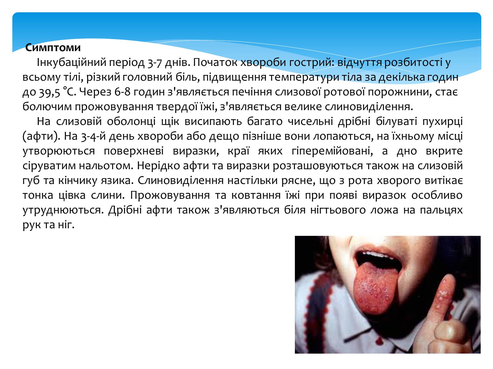Презентація на тему «Інфекційні захворювання» (варіант 5) - Слайд #8 Презентація на тему «Інфекційні захворювання» (варіант 5) - Слайд #8