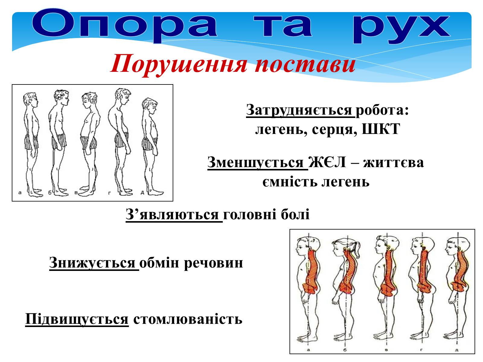 Презентація на тему «Опора і рух» - Слайд #28 Презентація на тему «Опора і рух» - Слайд #28