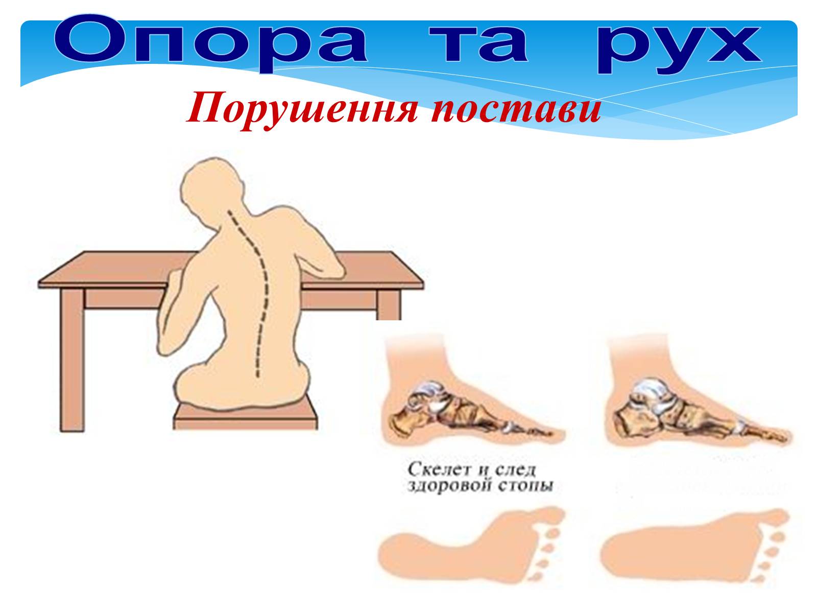 Презентація на тему «Опора і рух» - Слайд #29 Презентація на тему «Опора і рух» - Слайд #29