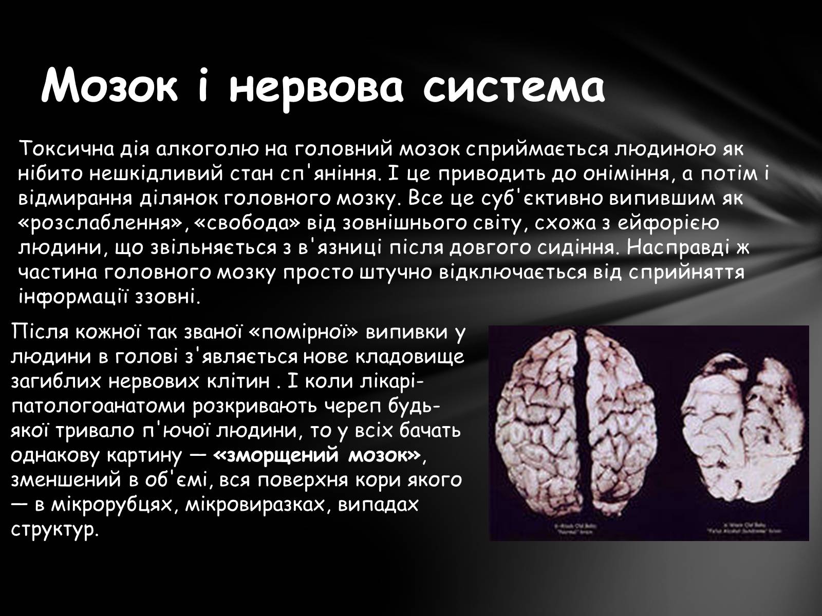 Презентація на тему «Шкідливий вплив алкоголю на організм» - Слайд #13 Презентація на тему «Шкідливий вплив алкоголю на організм» - Слайд #13