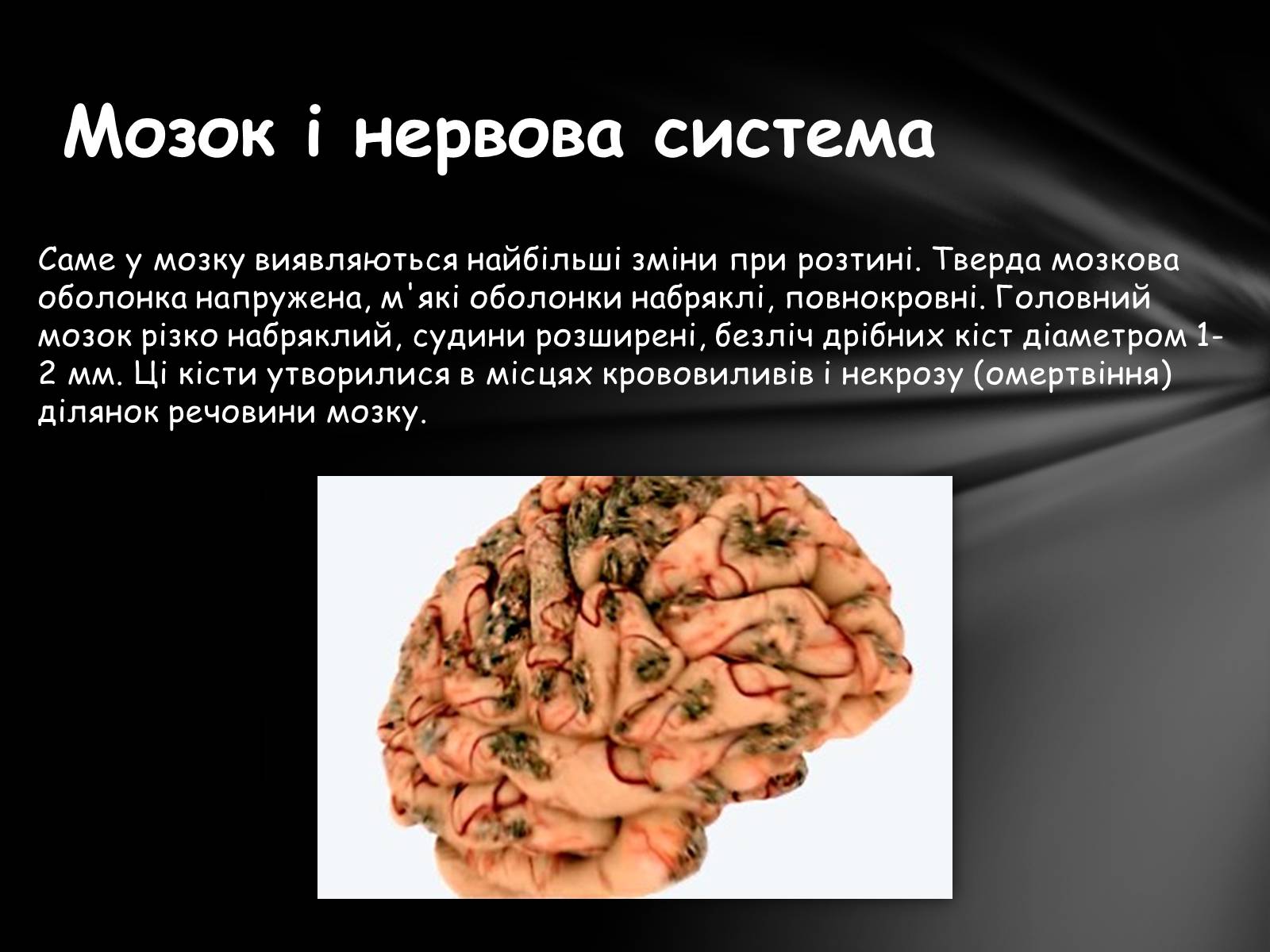 Презентація на тему «Шкідливий вплив алкоголю на організм» - Слайд #14 Презентація на тему «Шкідливий вплив алкоголю на організм» - Слайд #14