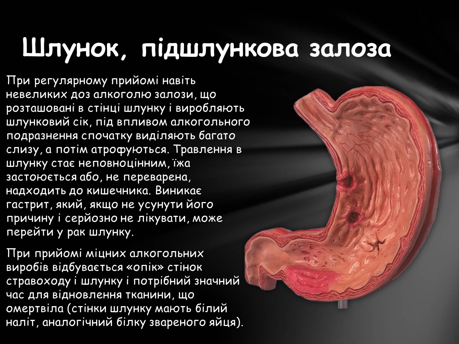 Презентація на тему «Шкідливий вплив алкоголю на організм» - Слайд #22 Презентація на тему «Шкідливий вплив алкоголю на організм» - Слайд #22