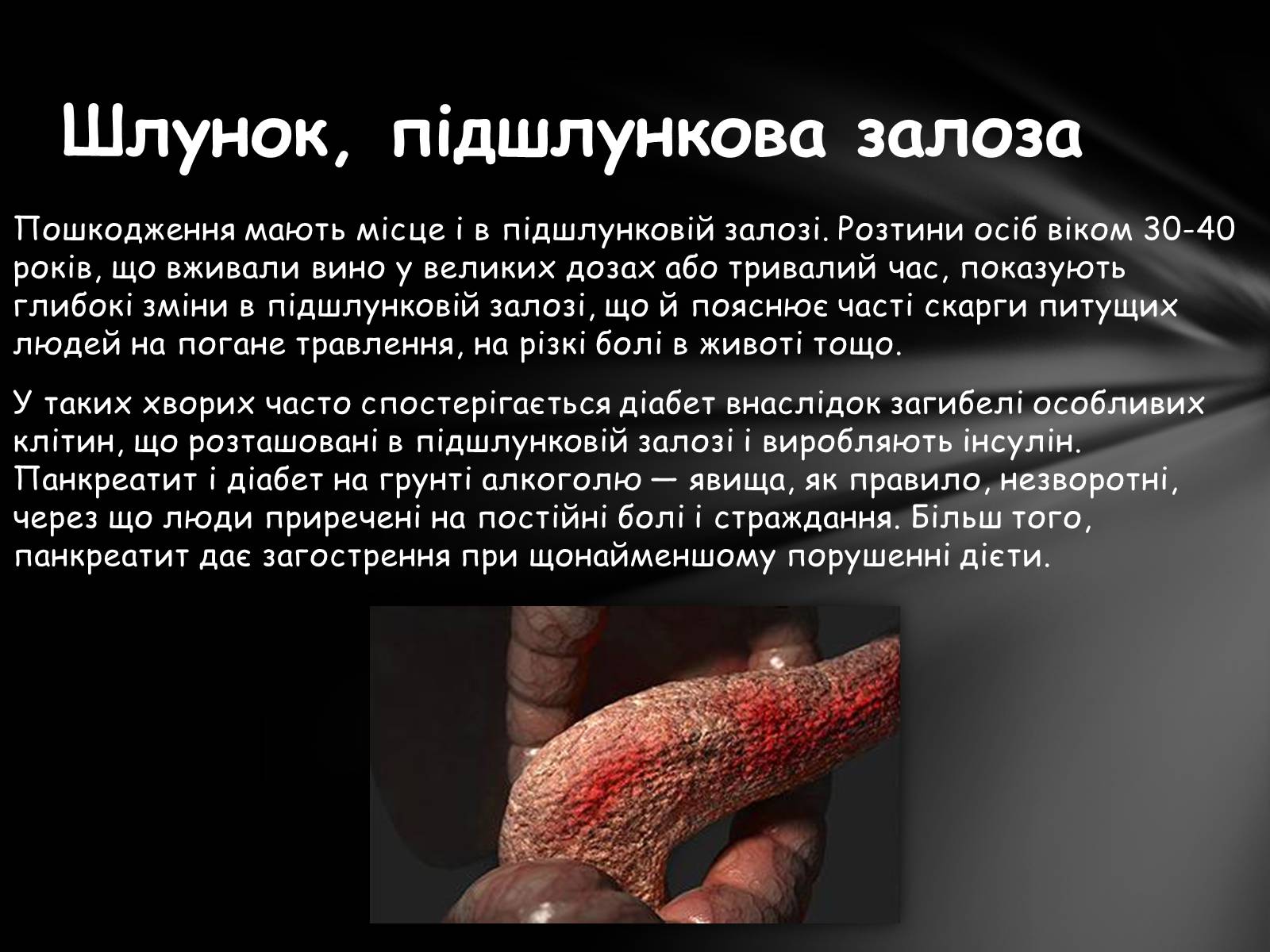 Презентація на тему «Шкідливий вплив алкоголю на організм» - Слайд #23 Презентація на тему «Шкідливий вплив алкоголю на організм» - Слайд #23