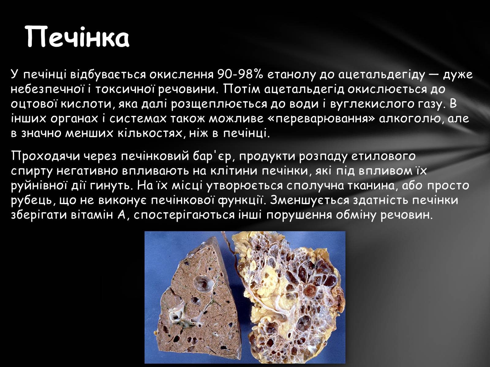 Презентація на тему «Шкідливий вплив алкоголю на організм» - Слайд #24 Презентація на тему «Шкідливий вплив алкоголю на організм» - Слайд #24