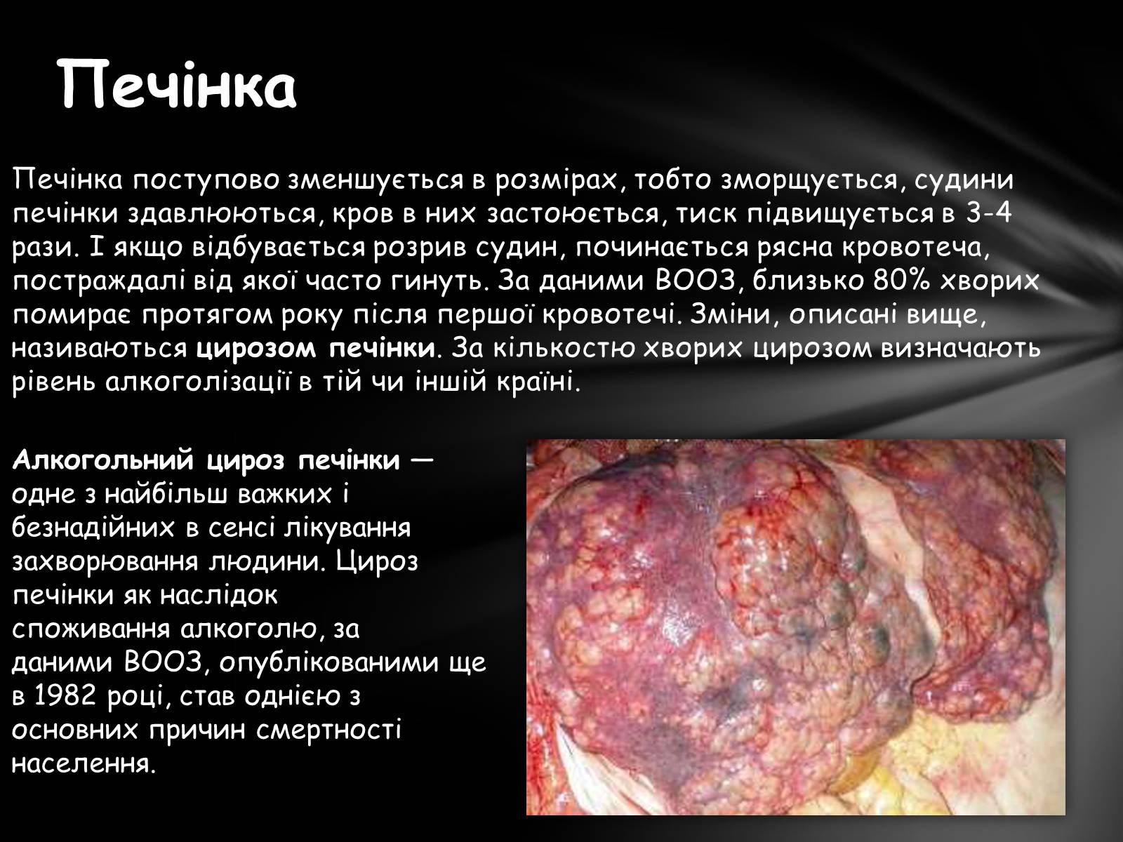 Презентація на тему «Шкідливий вплив алкоголю на організм» - Слайд #25 Презентація на тему «Шкідливий вплив алкоголю на організм» - Слайд #25