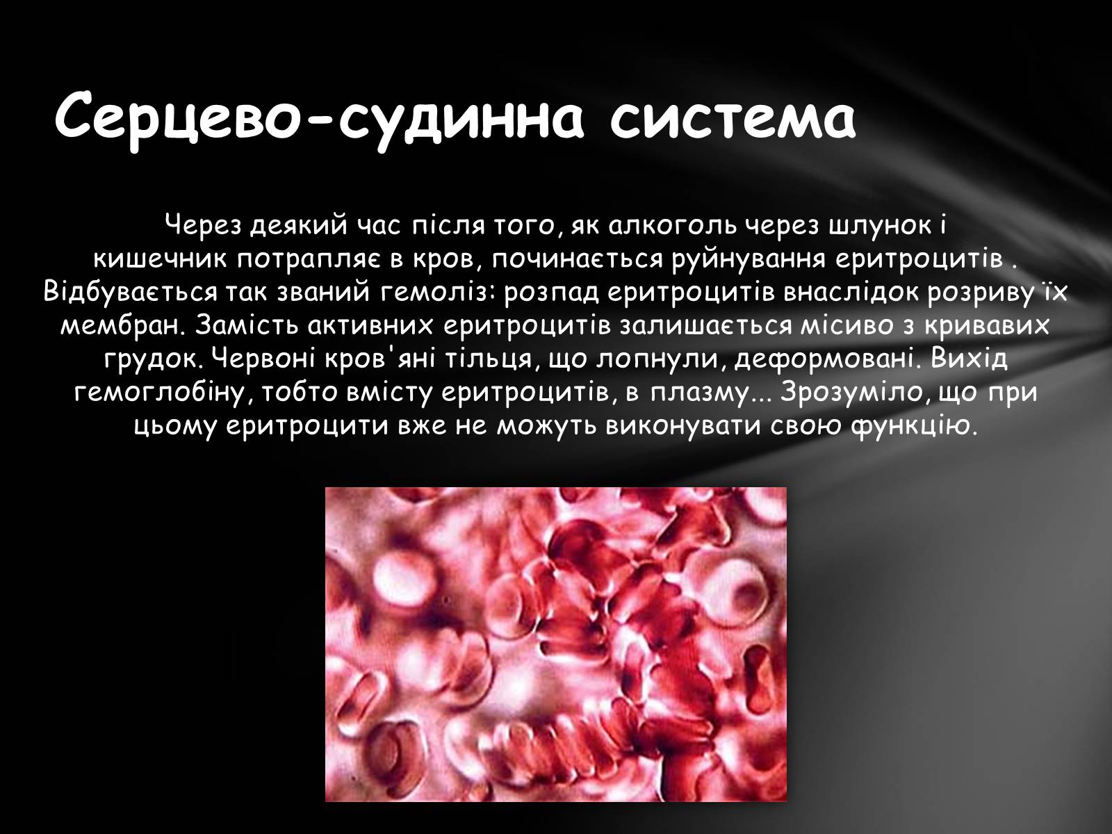 Презентація на тему «Шкідливий вплив алкоголю на організм» - Слайд #7 Презентація на тему «Шкідливий вплив алкоголю на організм» - Слайд #7
