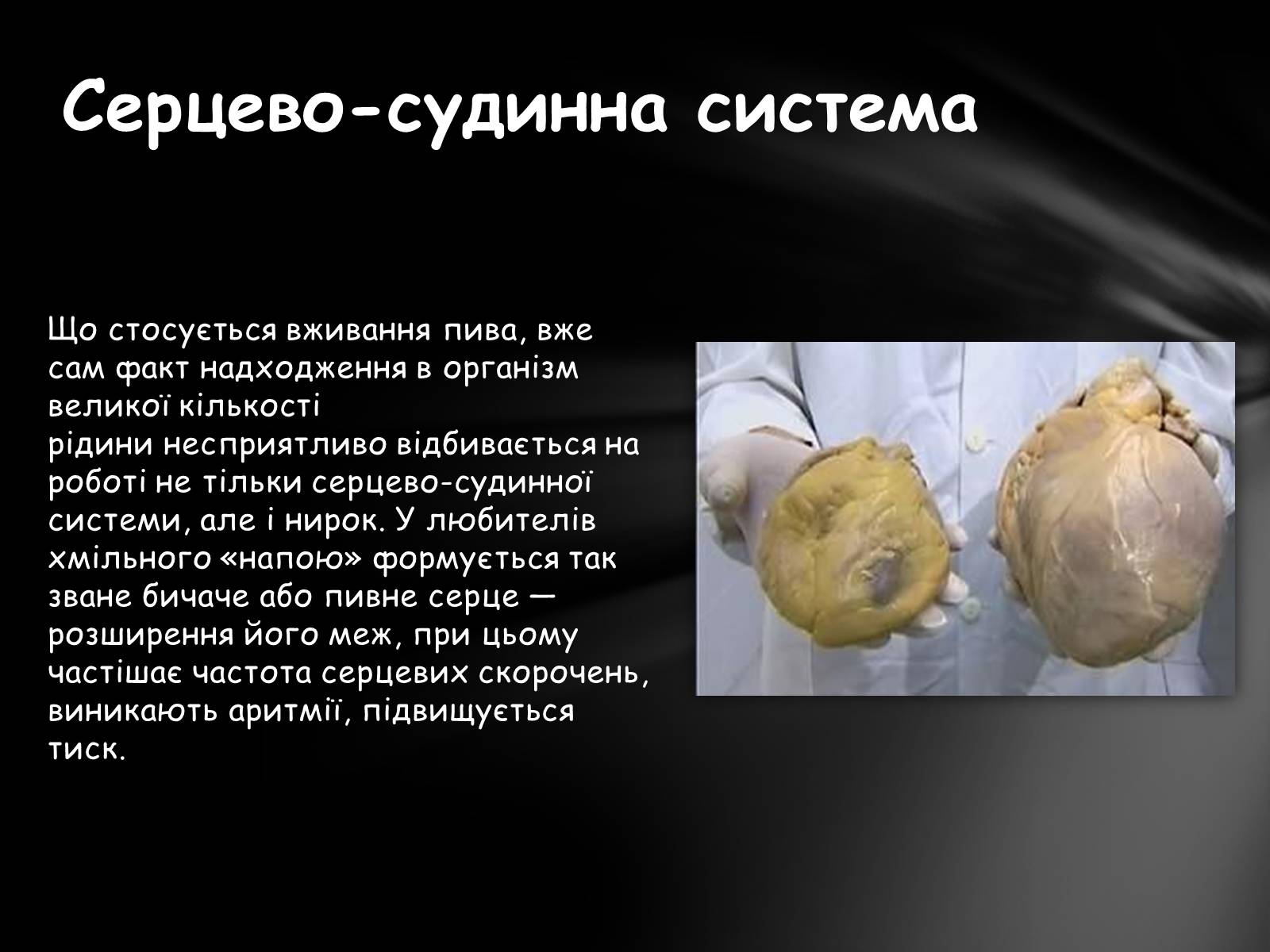 Презентація на тему «Шкідливий вплив алкоголю на організм» - Слайд #9 Презентація на тему «Шкідливий вплив алкоголю на організм» - Слайд #9