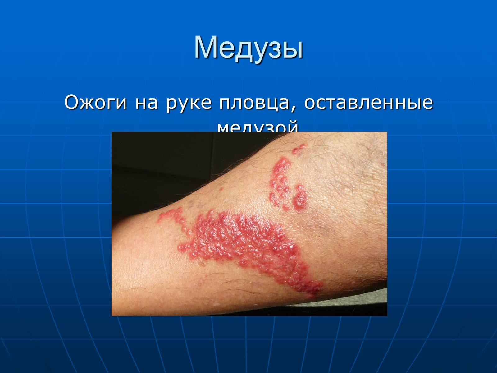 Презентація на тему «Медузи» (варіант 2) - Слайд #39 Презентація на тему «Медузи» (варіант 2) - Слайд #39