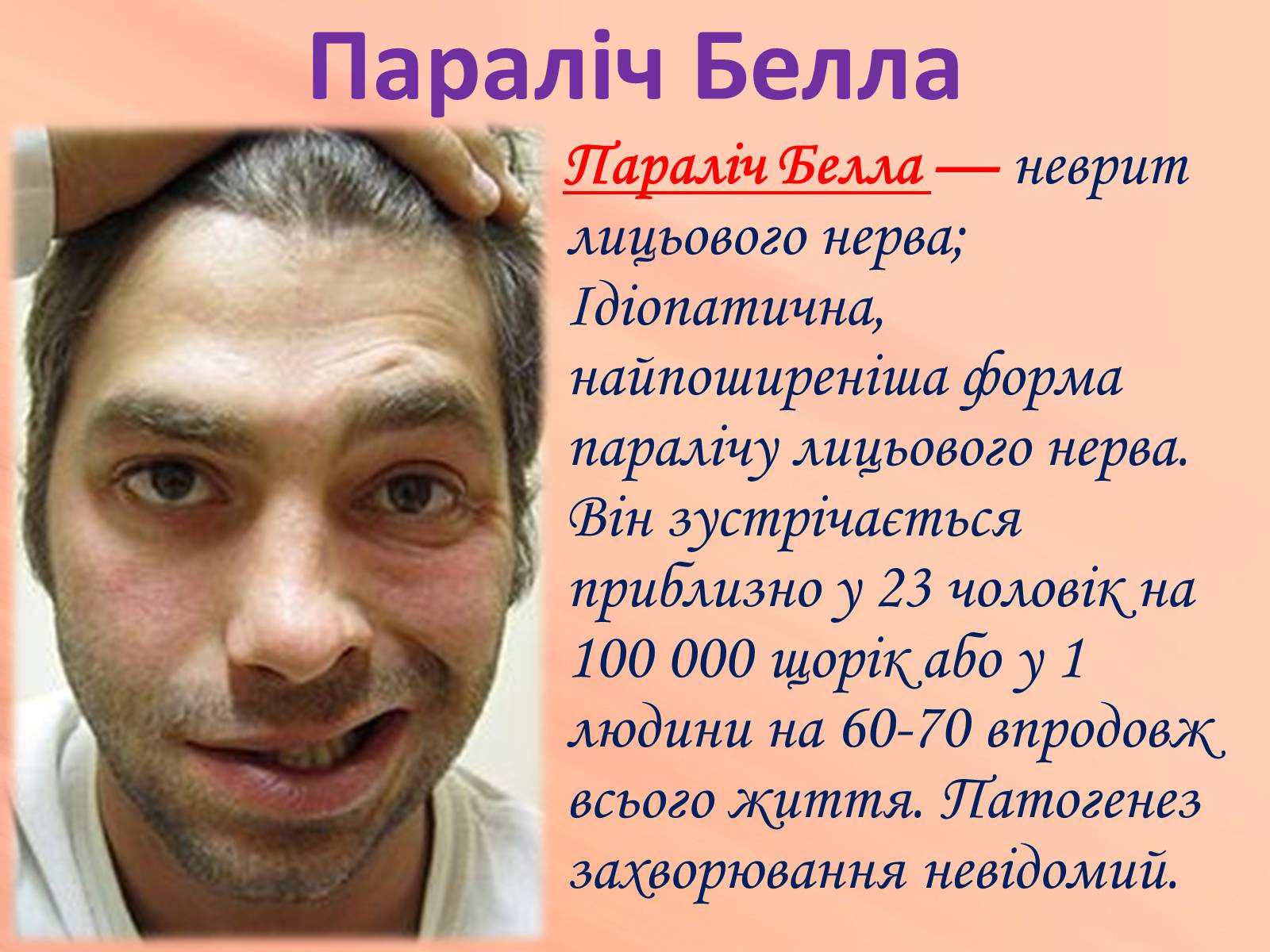 Презентація на тему «Хвороби нервової системи» (варіант 1) - Слайд #28 Презентація на тему «Хвороби нервової системи» (варіант 1) - Слайд #28