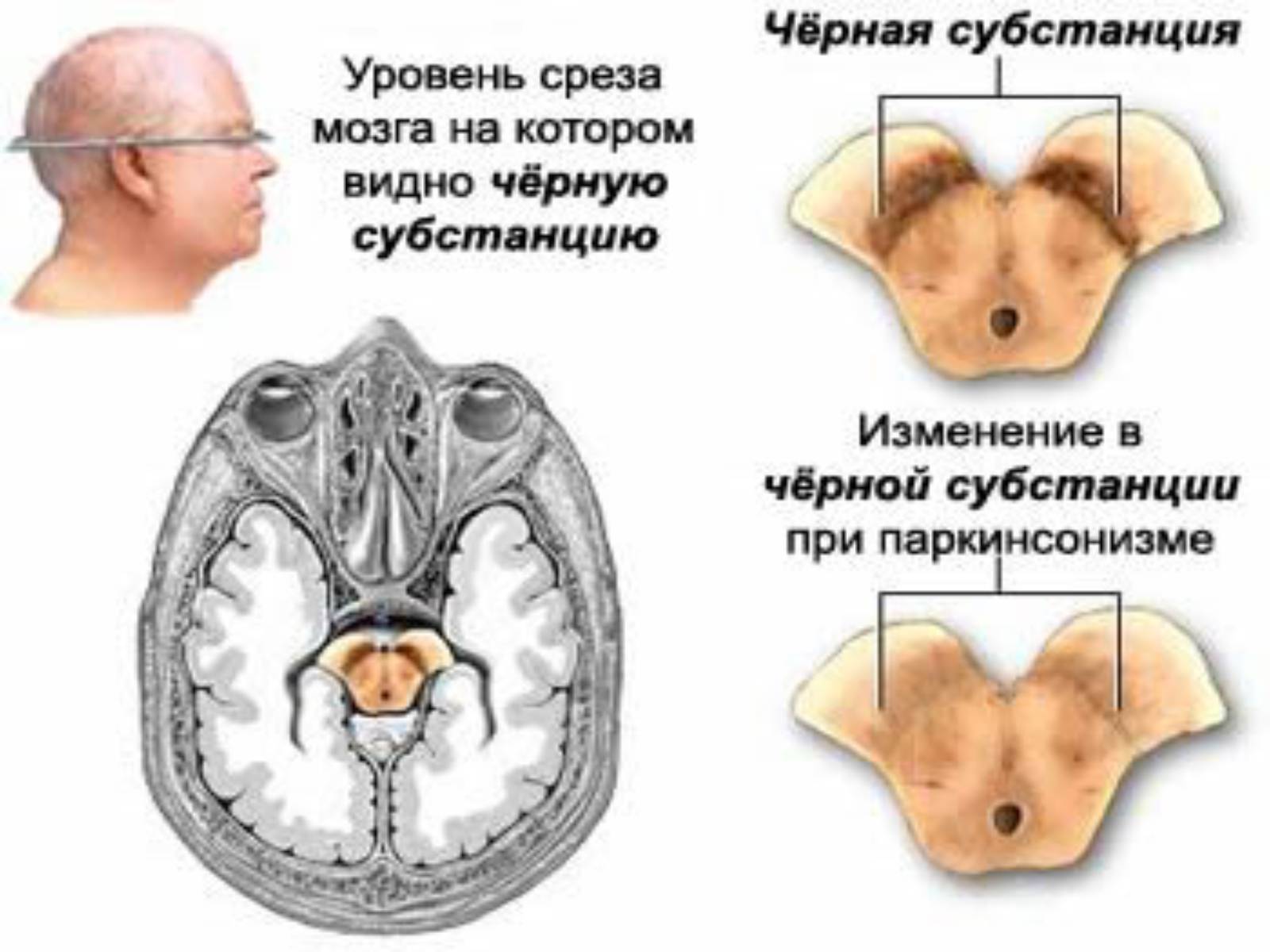 Презентація на тему «Хвороби нервової системи» (варіант 1) - Слайд #7 Презентація на тему «Хвороби нервової системи» (варіант 1) - Слайд #7