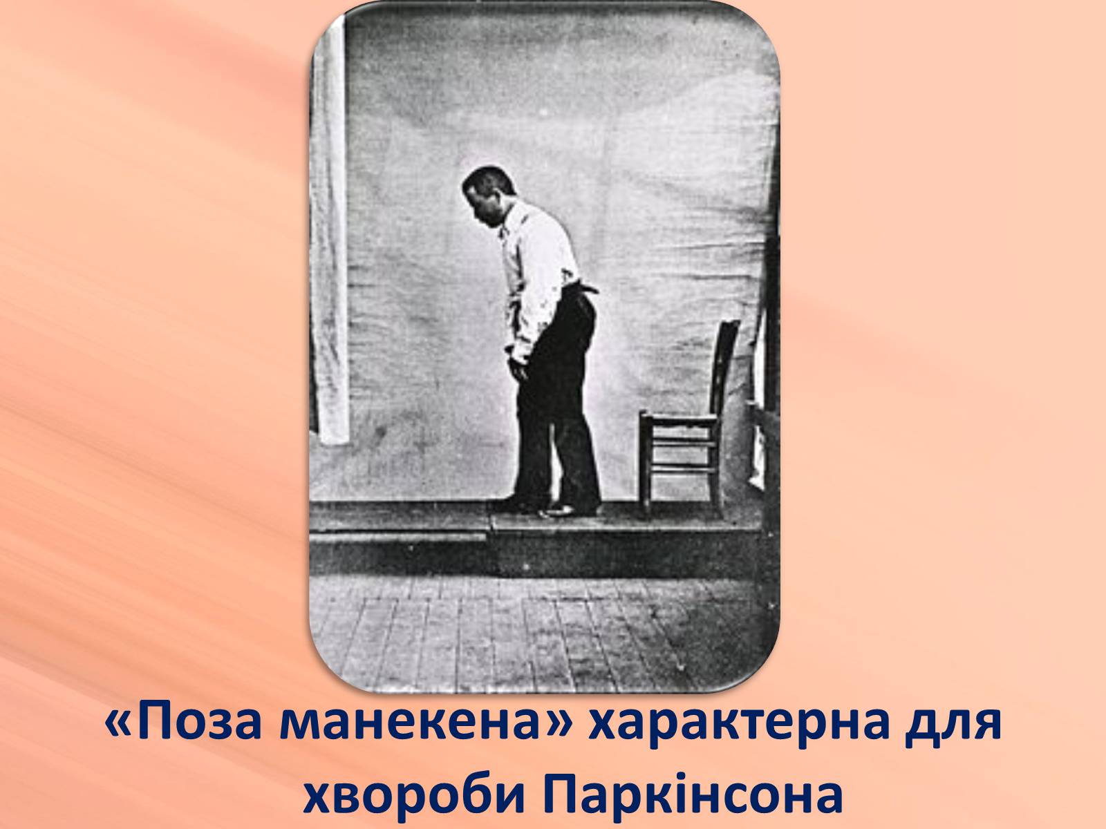 Презентація на тему «Хвороби нервової системи» (варіант 1) - Слайд #9 Презентація на тему «Хвороби нервової системи» (варіант 1) - Слайд #9
