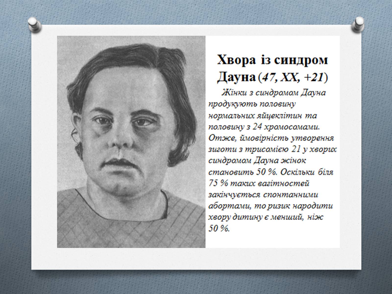Презентація на тему «Генетичні хвороби» - Слайд #12 Презентація на тему «Генетичні хвороби» - Слайд #12