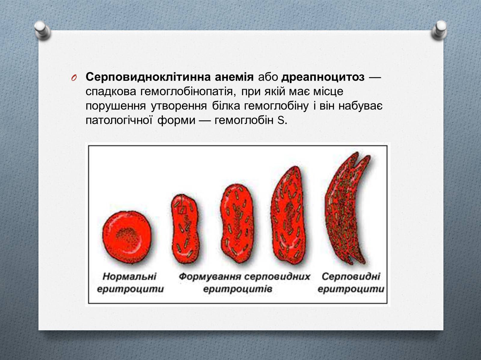 Презентація на тему «Генетичні хвороби» - Слайд #6 Презентація на тему «Генетичні хвороби» - Слайд #6