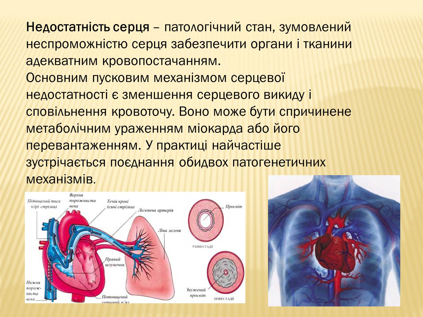 Презентація на тему «Захворювання серцево-судинної системи» (варіант 3) - Слайд #10 Презентація на тему «Захворювання серцево-судинної системи» (варіант 3) - Слайд #10