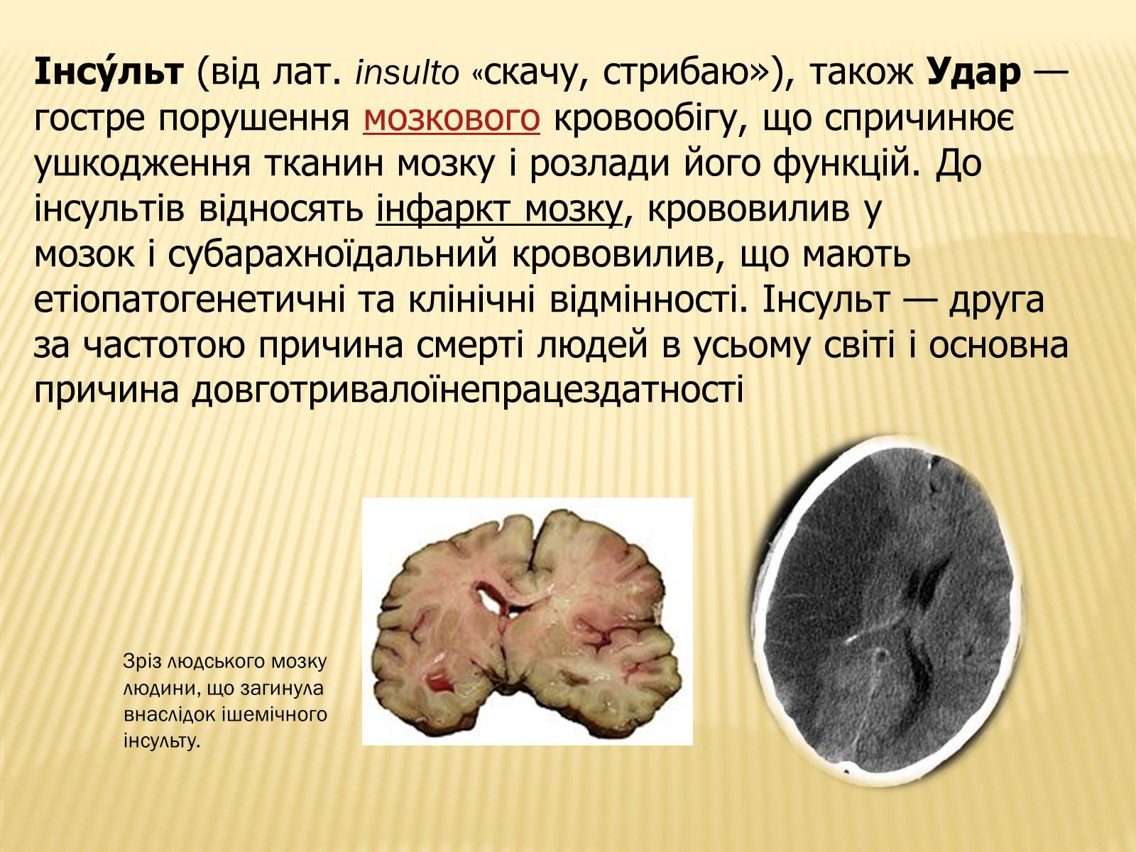 Презентація на тему «Захворювання серцево-судинної системи» (варіант 3) - Слайд #11 Презентація на тему «Захворювання серцево-судинної системи» (варіант 3) - Слайд #11