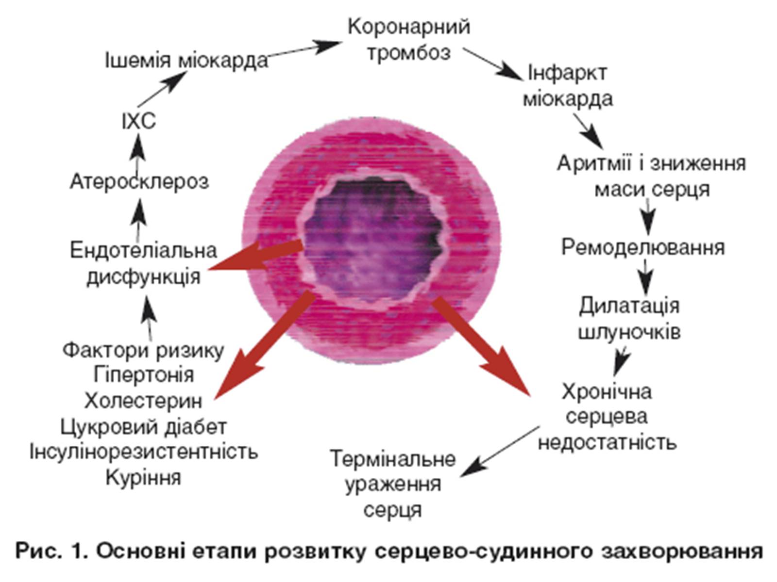 Презентація на тему «Захворювання серцево-судинної системи» (варіант 3) - Слайд #12 Презентація на тему «Захворювання серцево-судинної системи» (варіант 3) - Слайд #12