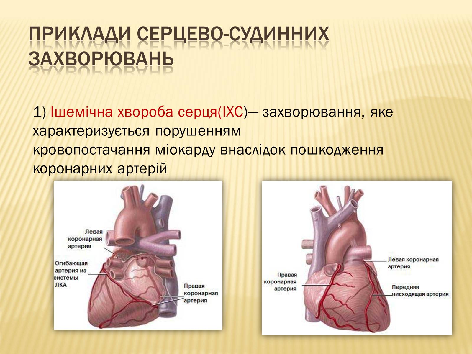 Презентація на тему «Захворювання серцево-судинної системи» (варіант 3) - Слайд #4 Презентація на тему «Захворювання серцево-судинної системи» (варіант 3) - Слайд #4