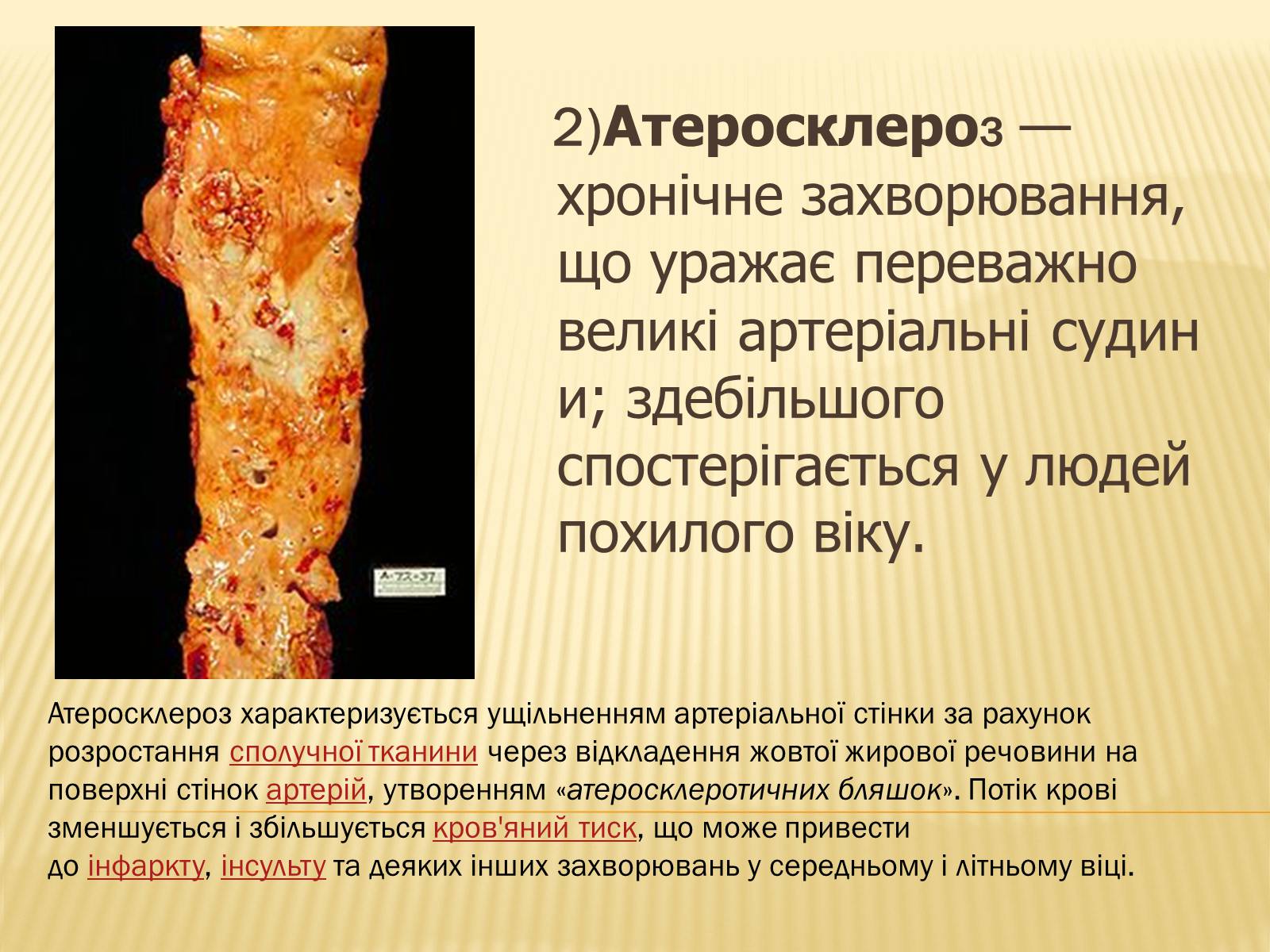 Презентація на тему «Захворювання серцево-судинної системи» (варіант 3) - Слайд #5 Презентація на тему «Захворювання серцево-судинної системи» (варіант 3) - Слайд #5