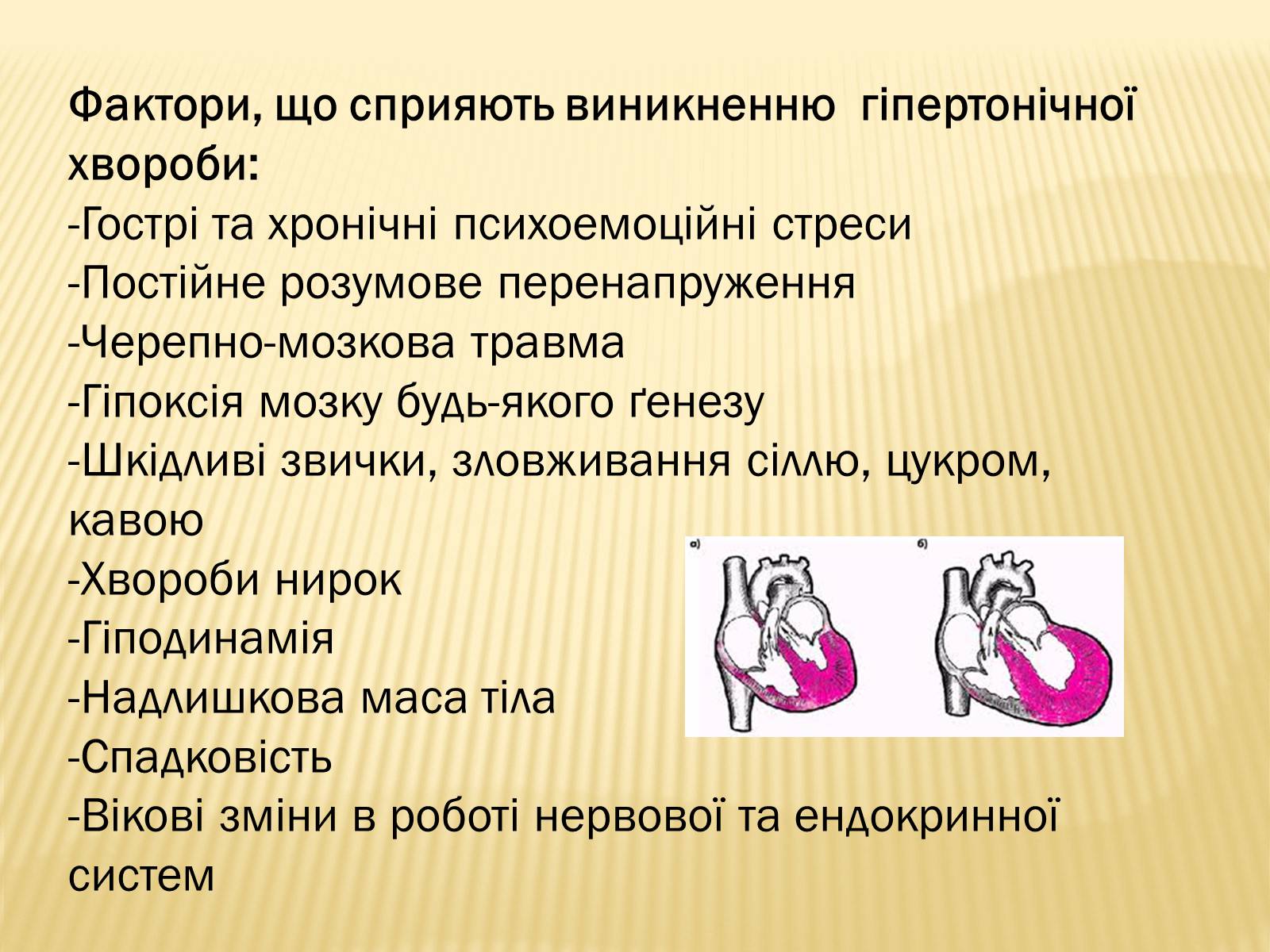 Презентація на тему «Захворювання серцево-судинної системи» (варіант 3) - Слайд #7 Презентація на тему «Захворювання серцево-судинної системи» (варіант 3) - Слайд #7