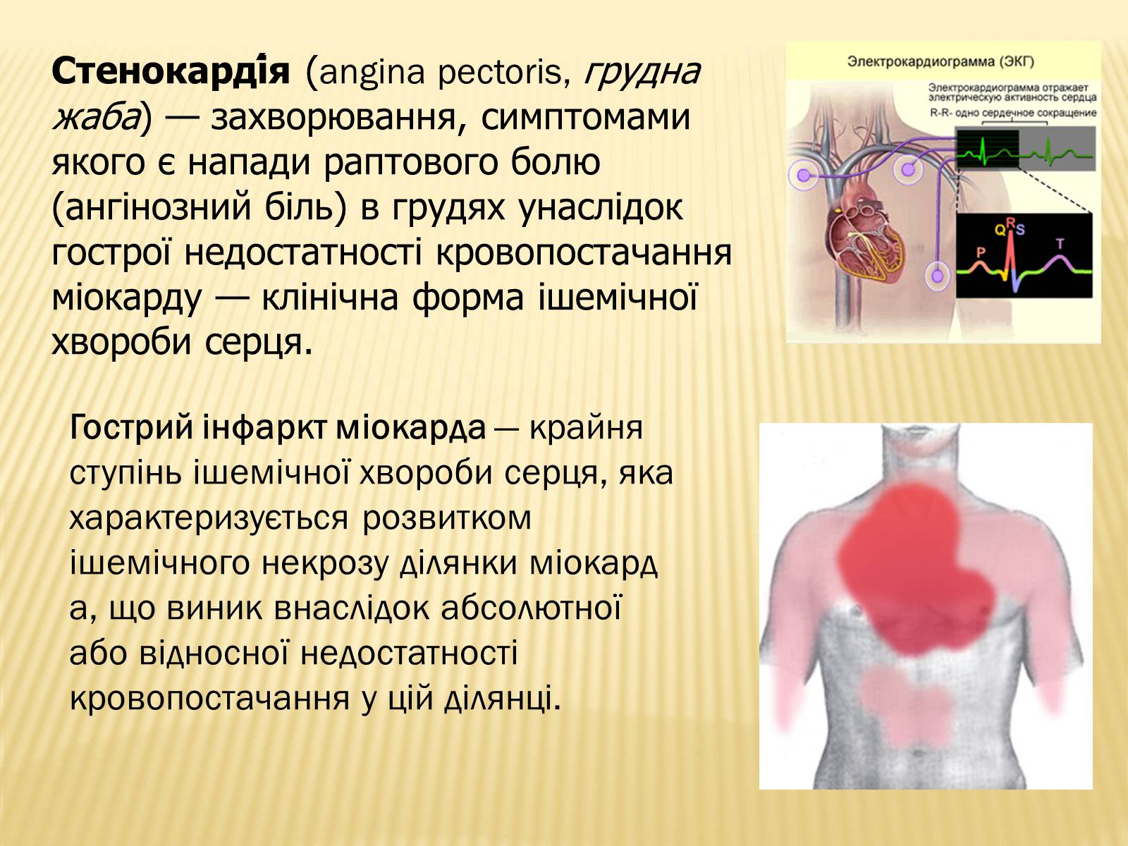 Презентація на тему «Захворювання серцево-судинної системи» (варіант 3) - Слайд #8 Презентація на тему «Захворювання серцево-судинної системи» (варіант 3) - Слайд #8